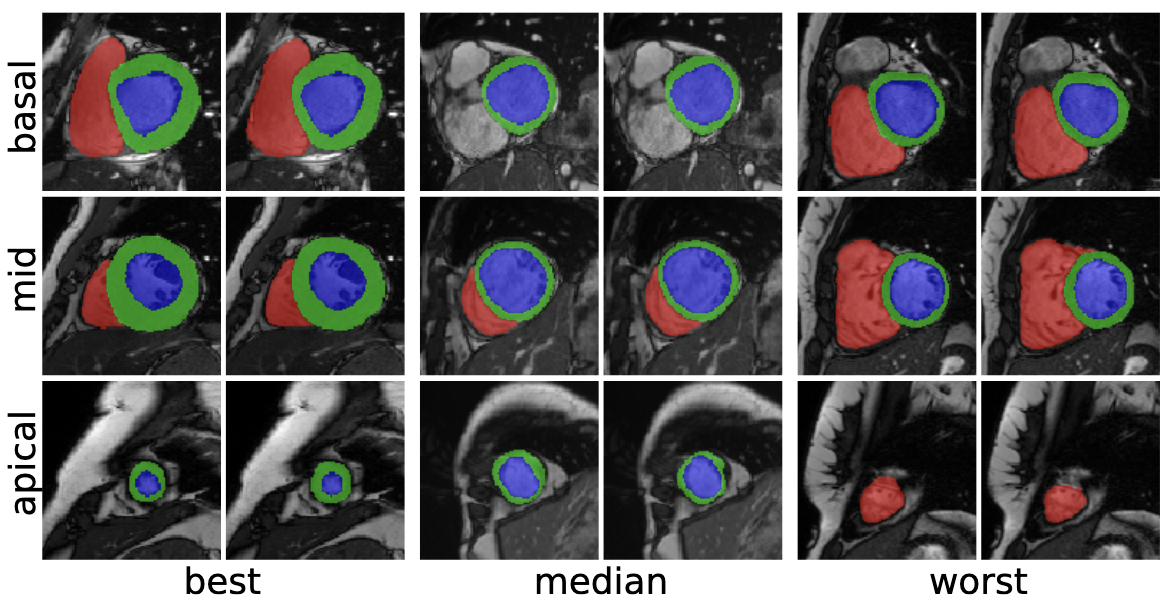 An exploration of 2D and 3D deep learning techniques for cardiac MR image segmentation